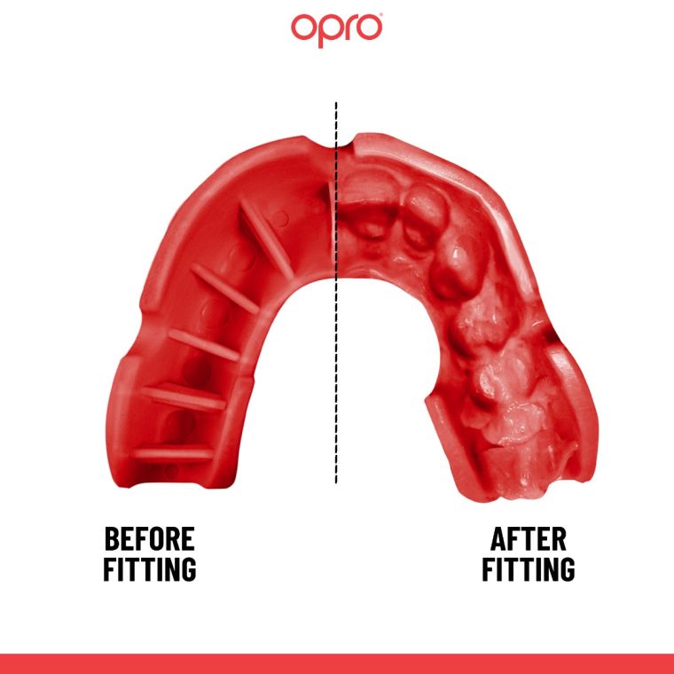 thumbnail image 2 of OPRO Junior Gold Self-Fit Mouth Guard – GEN4 Gum Shield For Kids Up To Age 10 2 of 3
