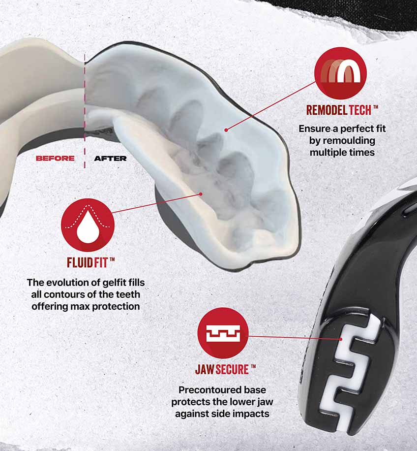 SAFEJAWZ® Extro Series Mouthguard